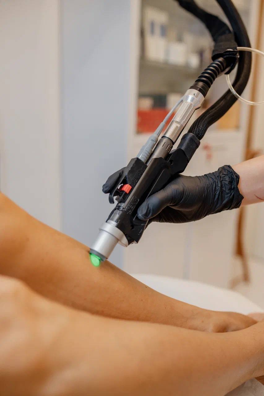 50% скидка на первую процедуру лазерной эпиляции